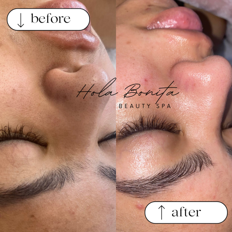 Beige Minimalist Skincare Before and After Instagram Post 1 768x768