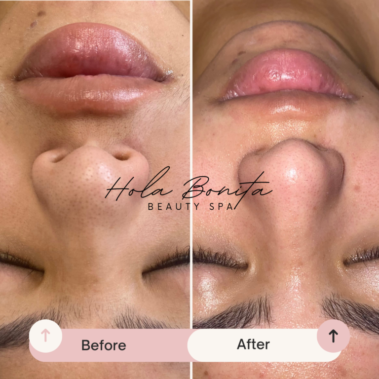 Beige Minimalist Skincare Before and After Instagram Post 768x768