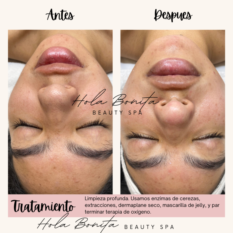 Neutral Before and After Instagram Post 1 768x768