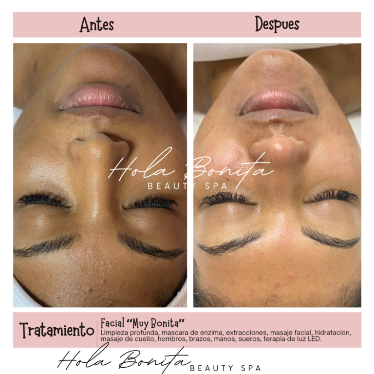 Neutral Before and After Instagram Post 5 768x768