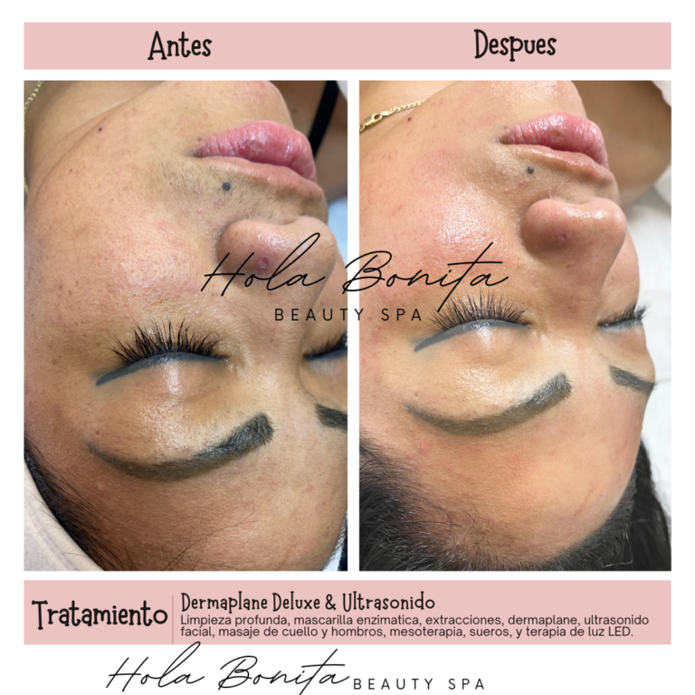 Neutral Before and After Instagram Post 6 768x768
